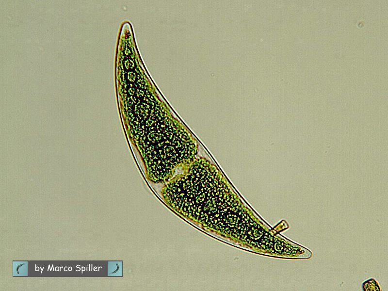Closterium moniliferum: un''alga contro la radioattivit�